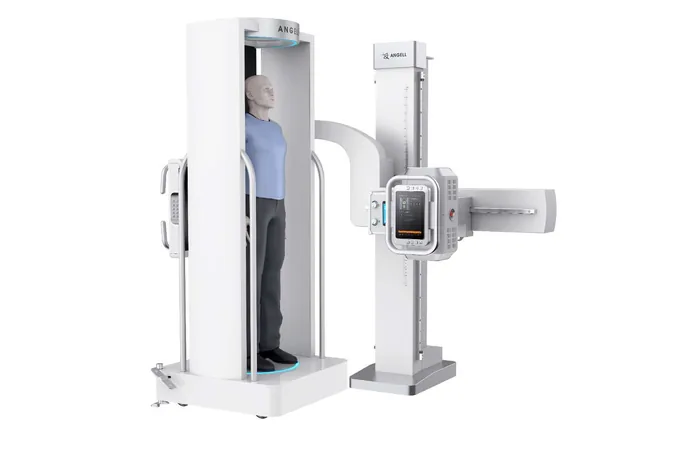 Sistema radiológico WR-3D vertical multifuncional ANGELL — equipo diagnóstico por imagen I-ME Colombia